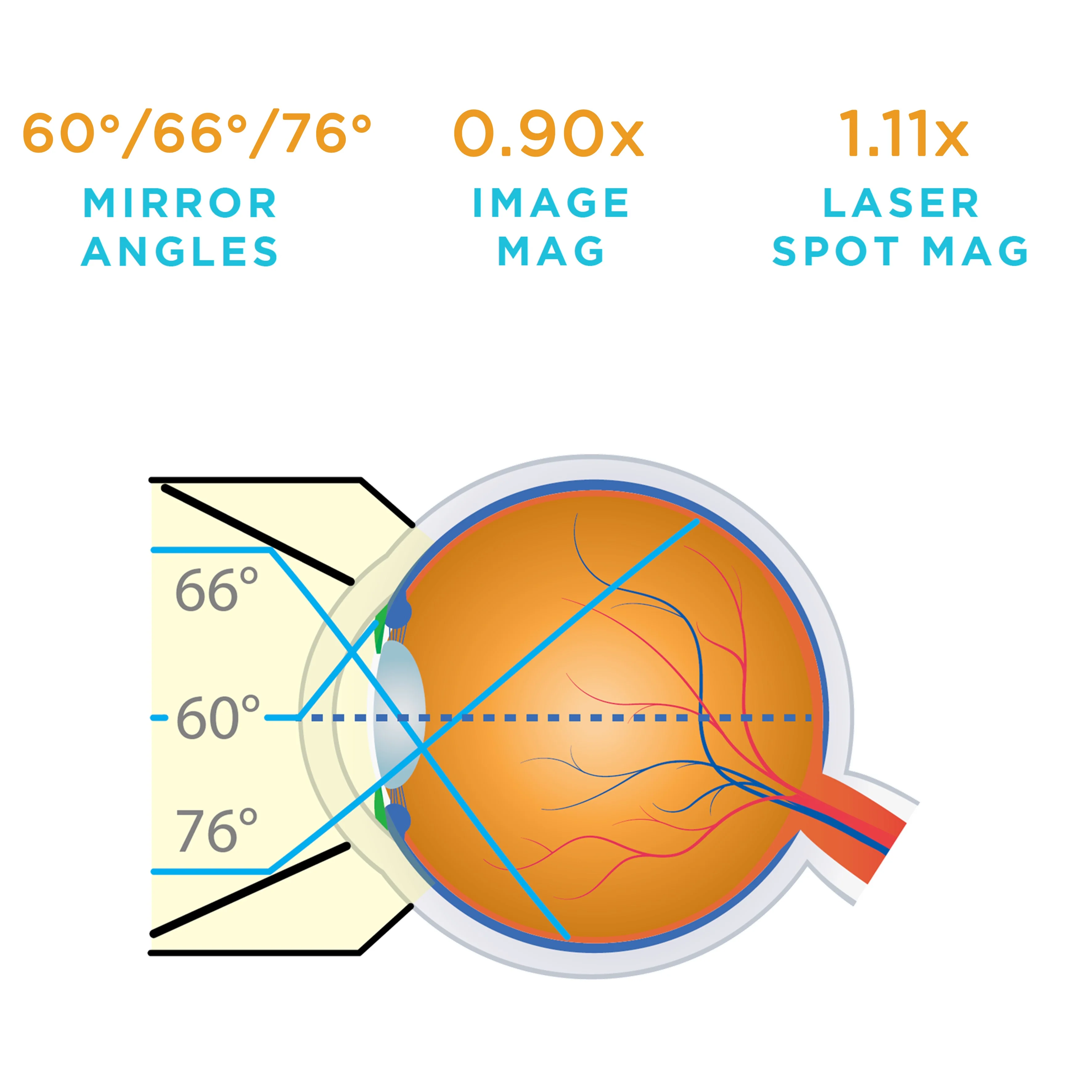 NEW 3-Mirror Lens - Image 6