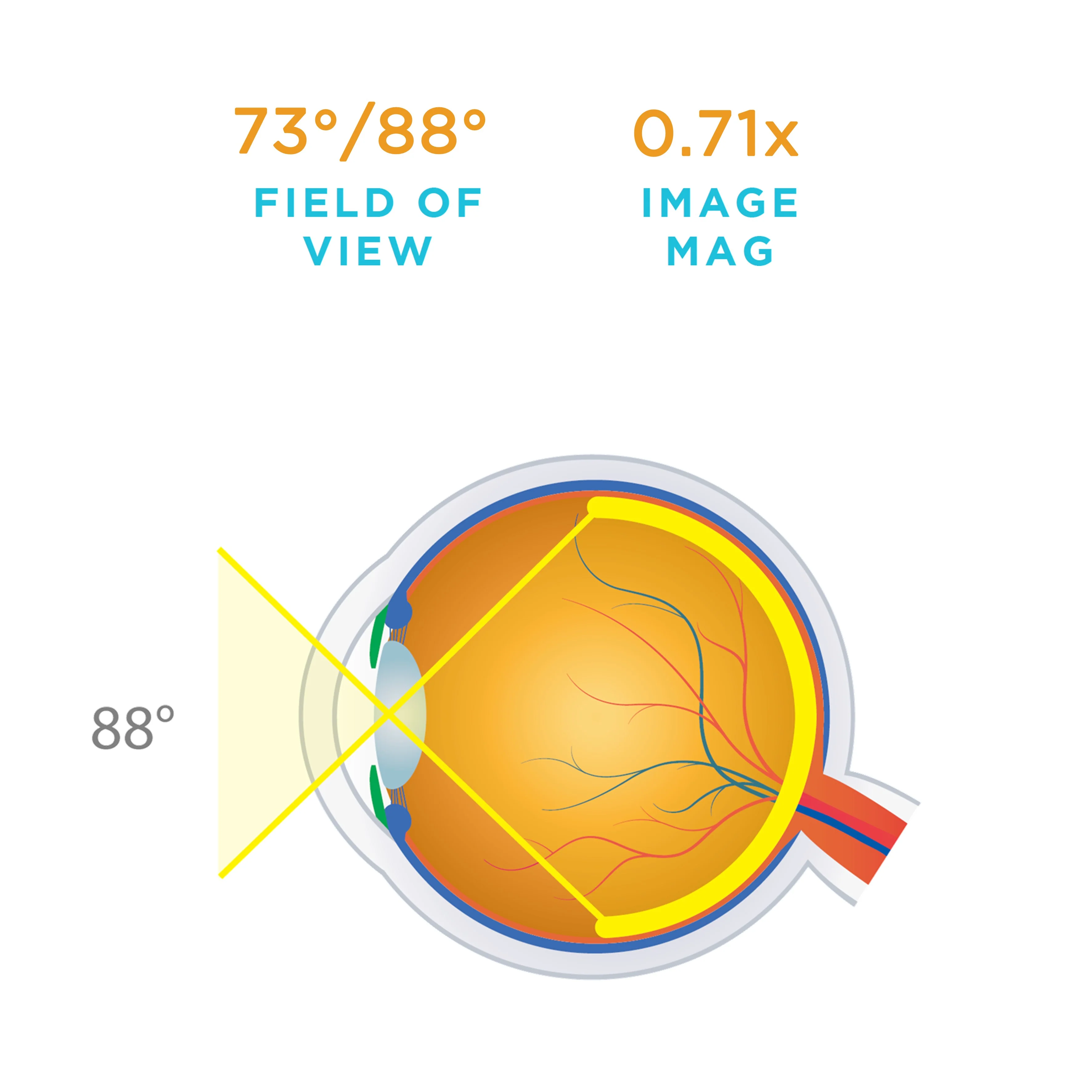 Central Retinal Lens - Image 3