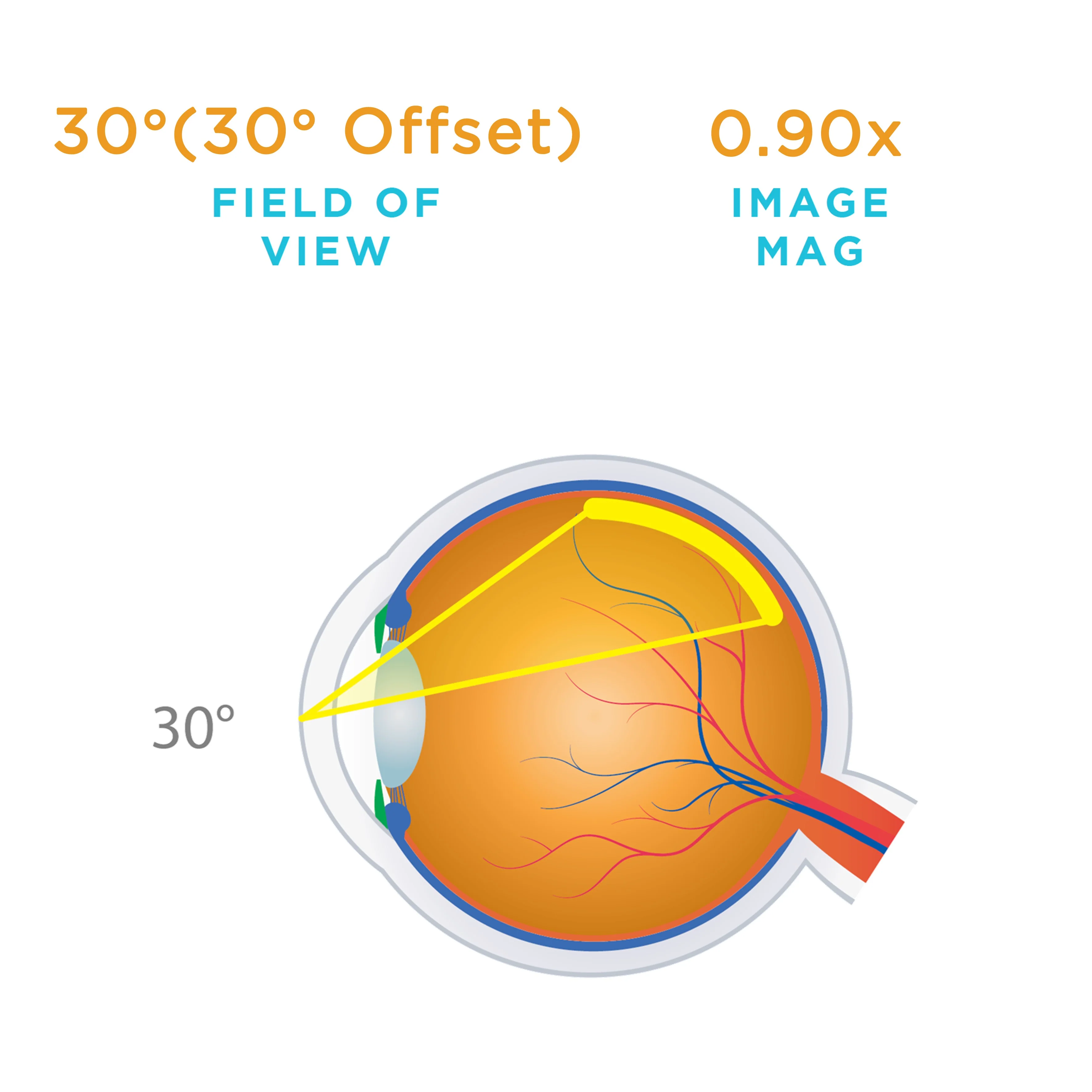 Direct Image Prism SSV® (ACS®) Lens - Image 5