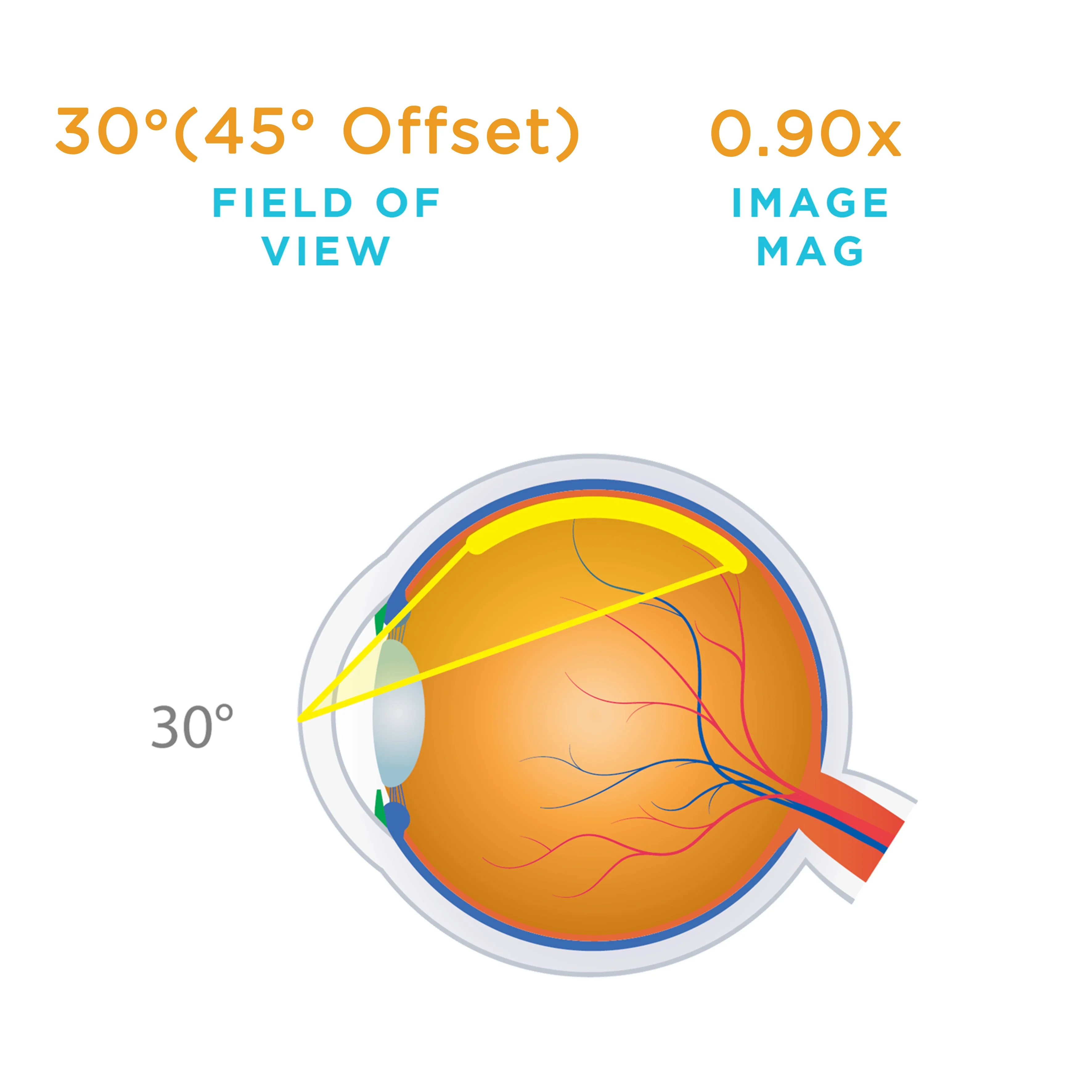 Direct Image Prism SSV® (ACS®) Lens - Image 6
