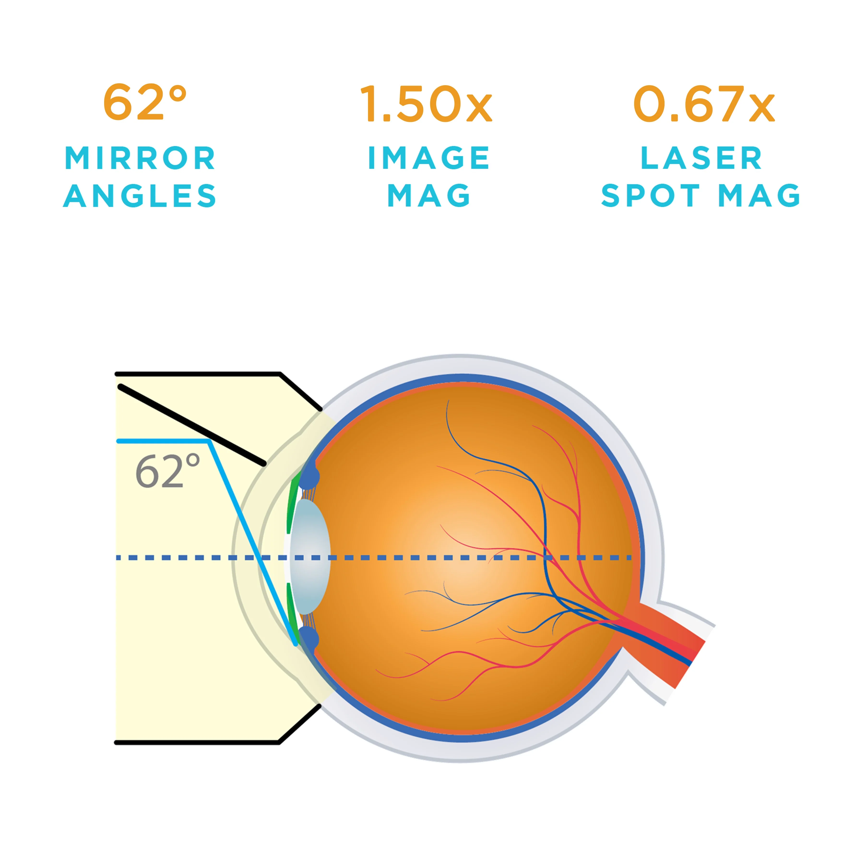 G-1 Gonio Lens - Image 3