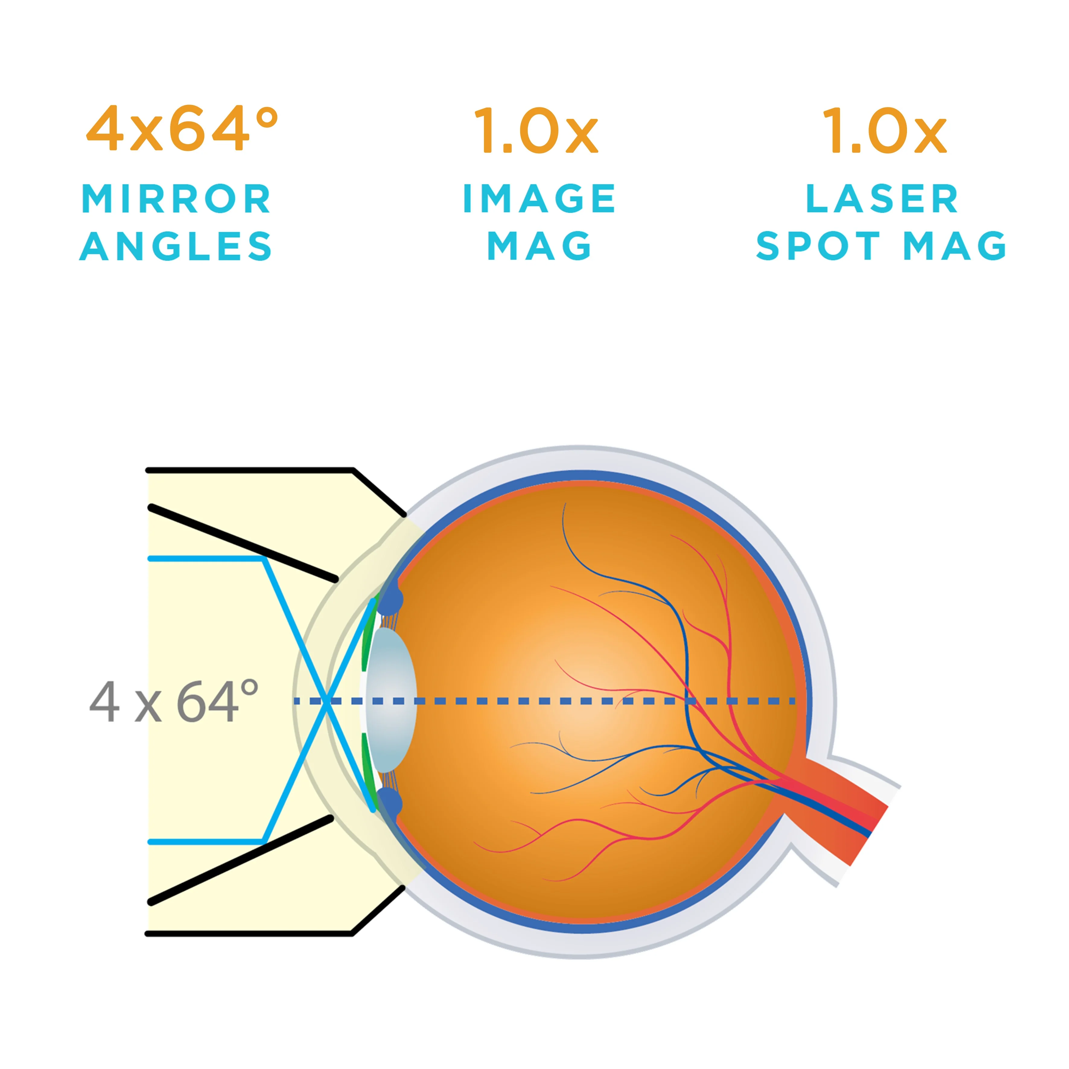 G-4 Mirror Gonio Lens - Image 4