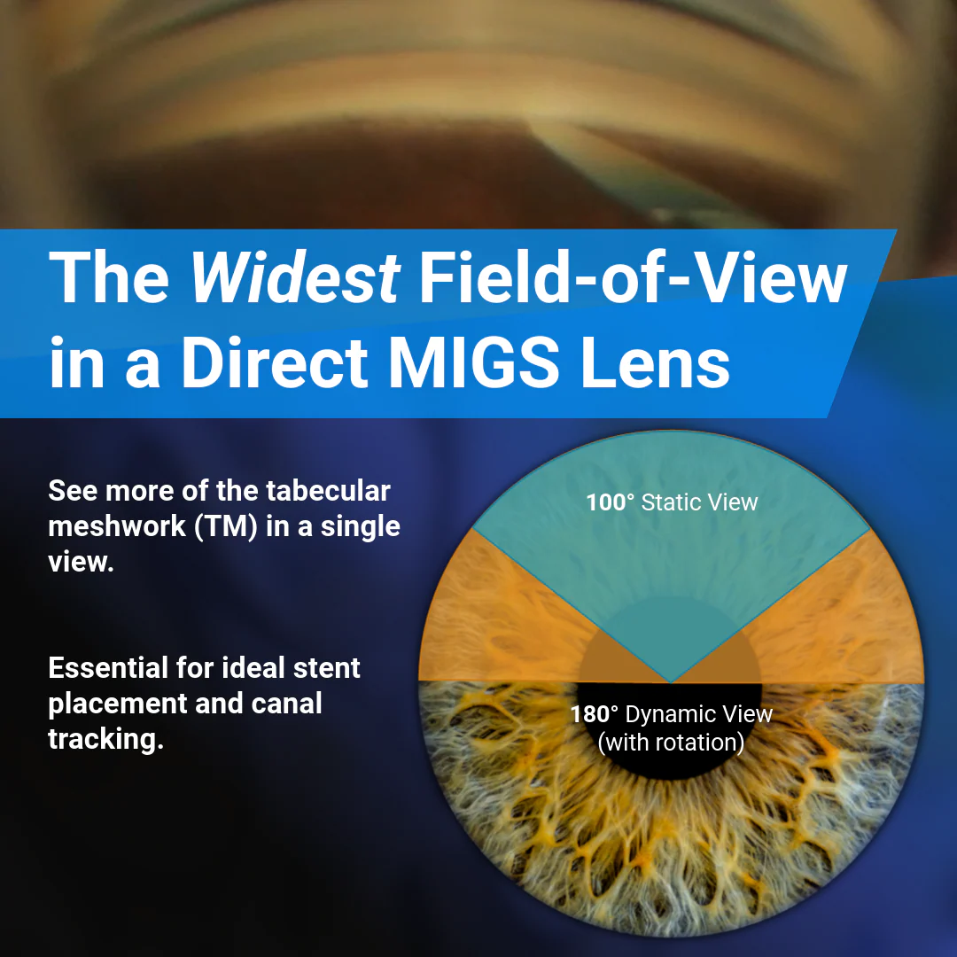 GonioPro Surgical Suite MIGS Lens - Image 2