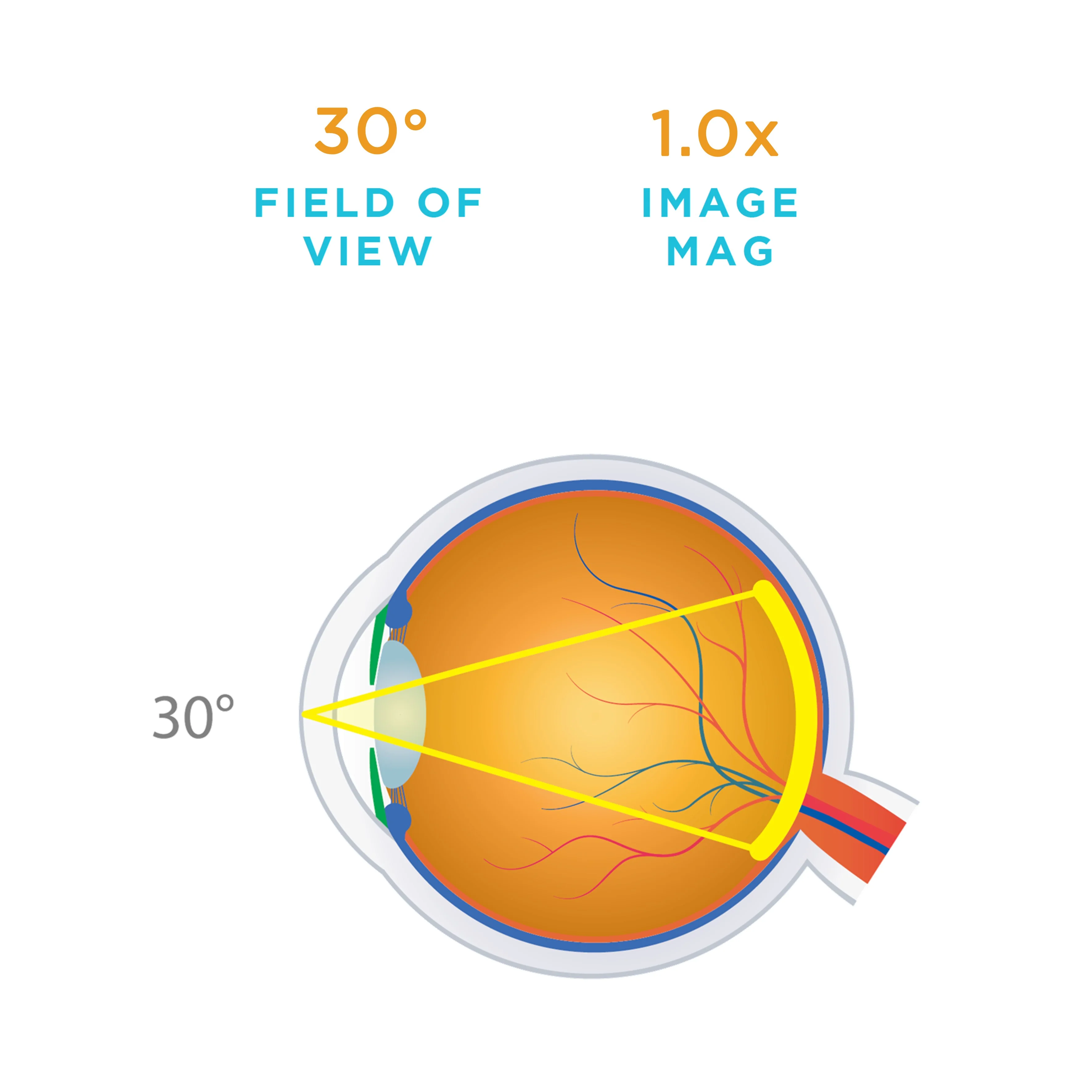 HR Direct 1X Lens - Image 3