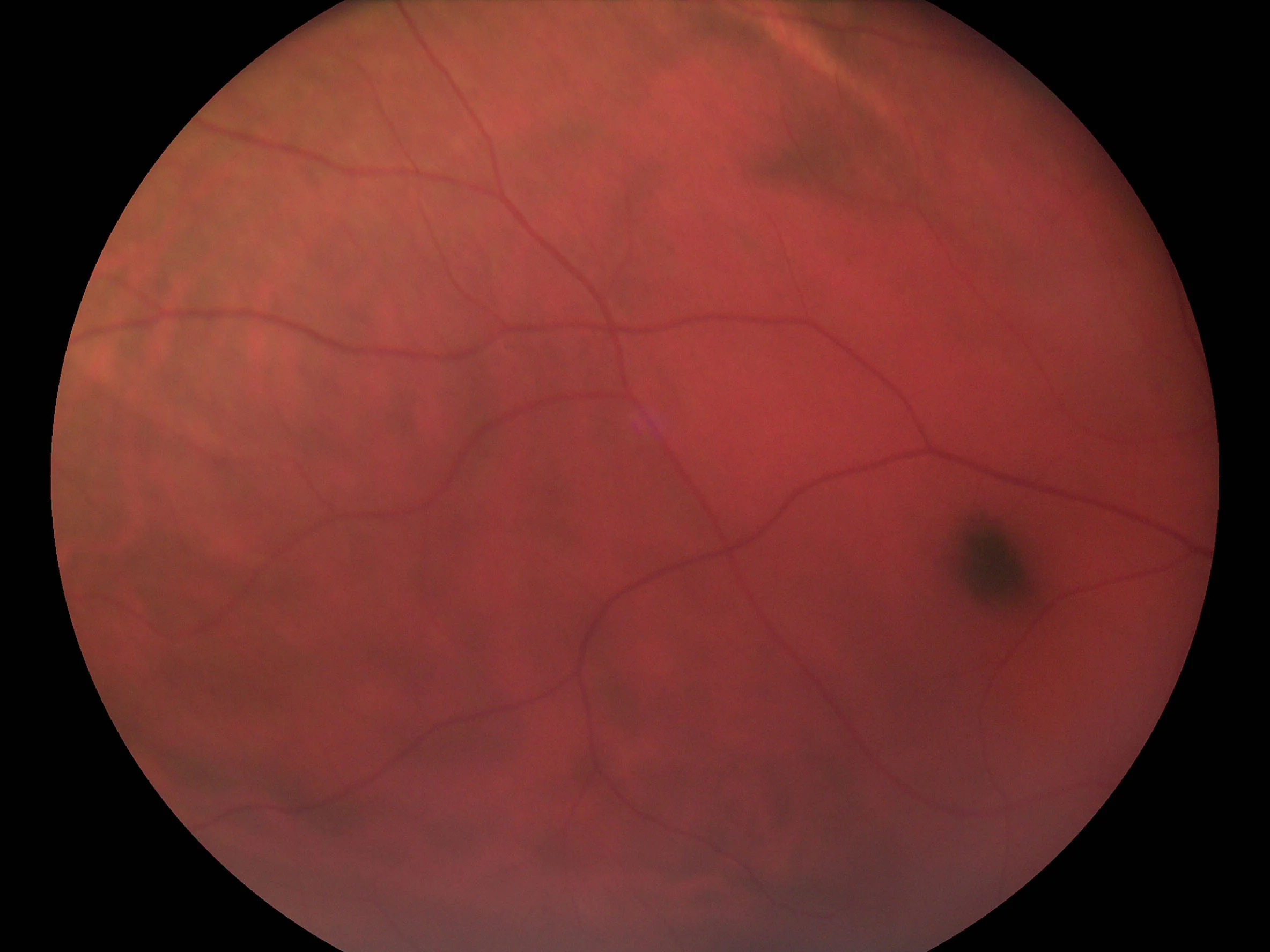 Pictor Prestige™ Handheld Fundus Camera with Optional Anterior Module - Image 4