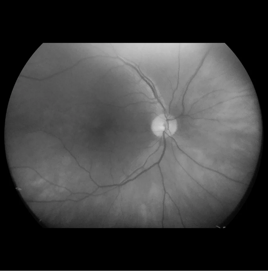 VistaView™ Mydriatic Portable Fundus Camera - Image 5
