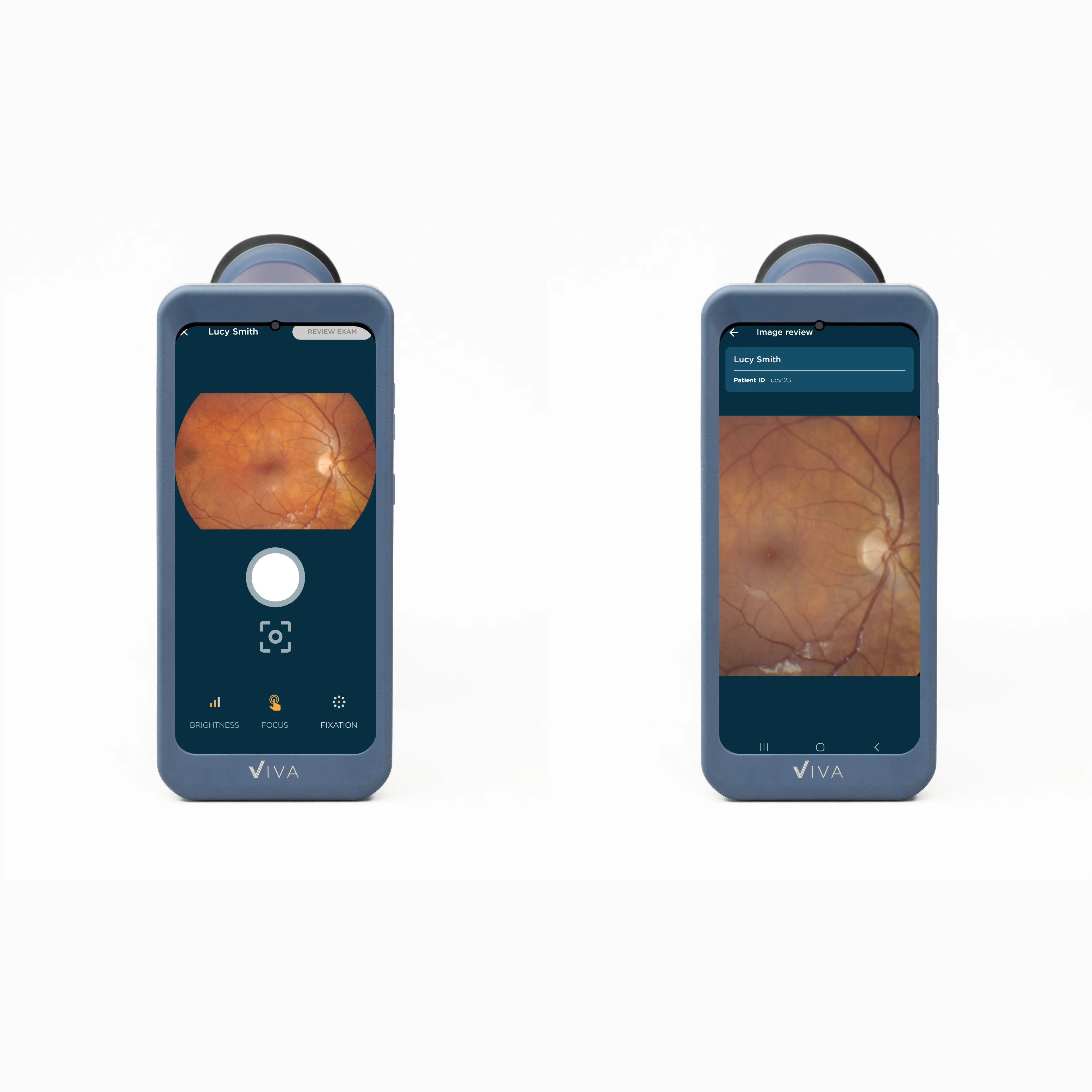 Viva Non-Mydriatic Handheld Retinal Camera - Image 12