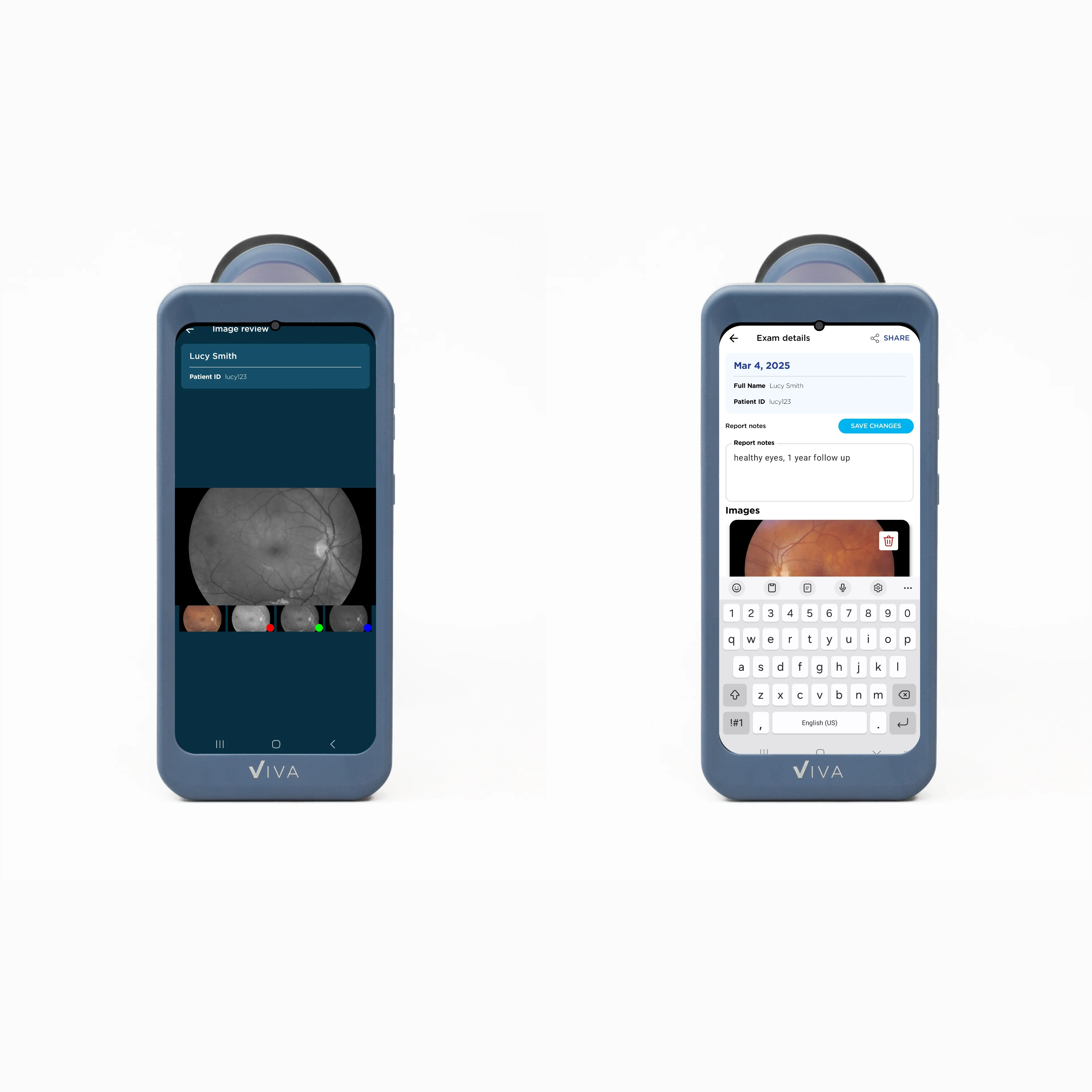 Viva Non-Mydriatic Handheld Retinal Camera - Image 13