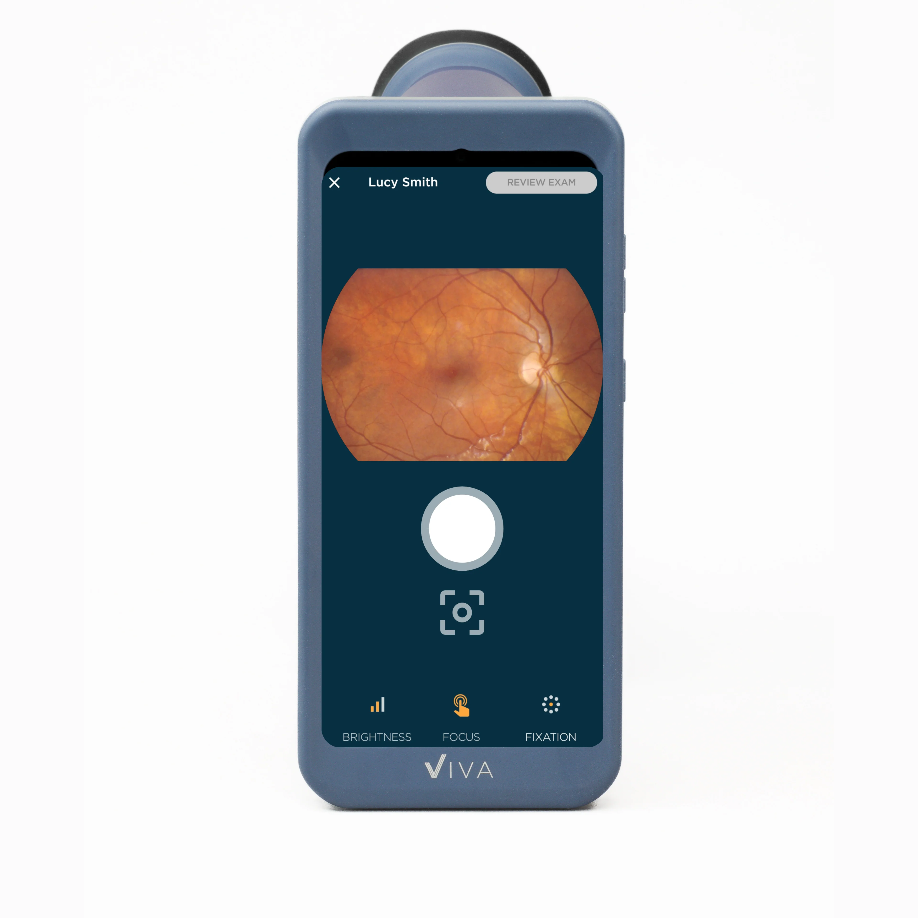 Viva Non-Mydriatic Handheld Retinal Camera - Image 3