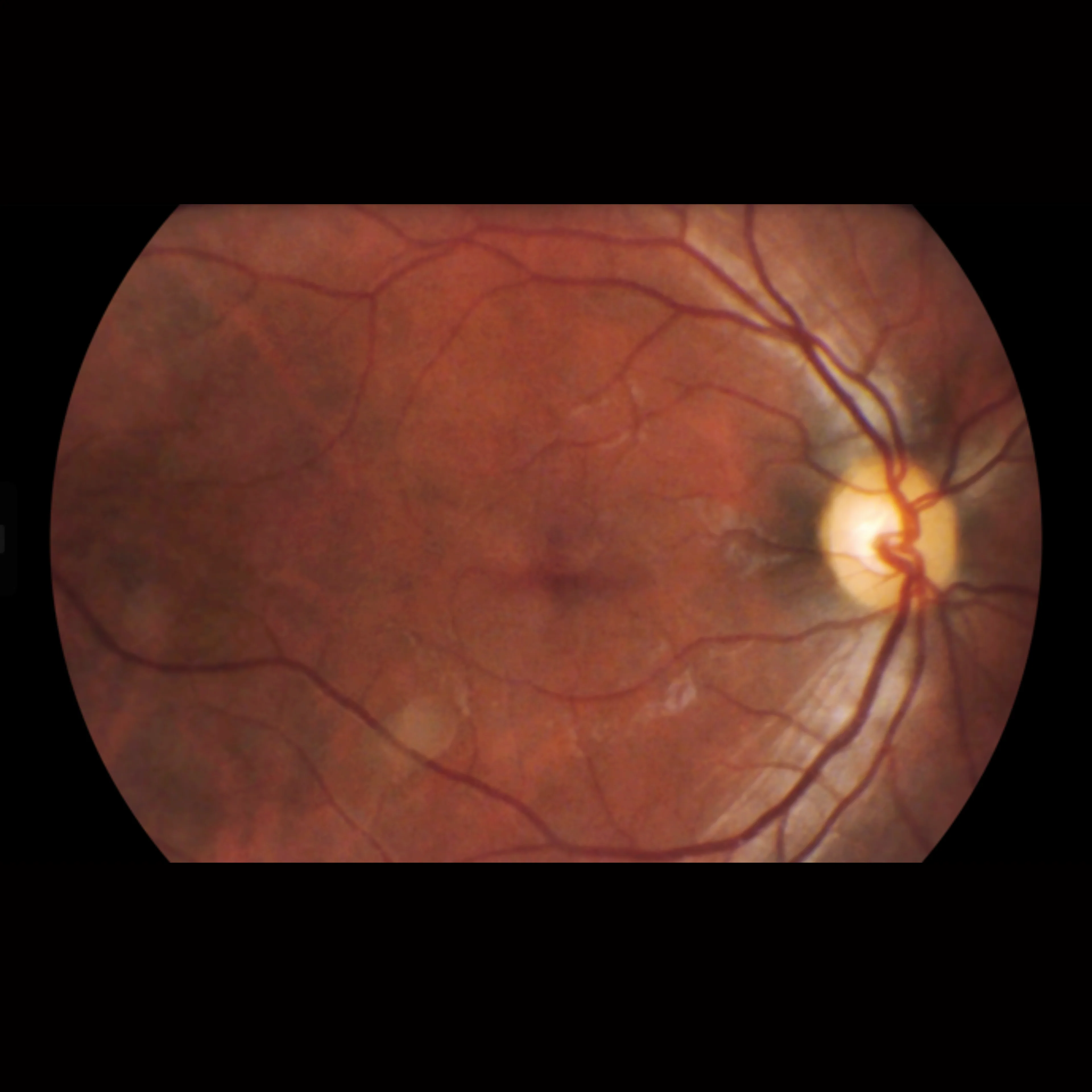 Viva Non-Mydriatic Handheld Retinal Camera - Image 8